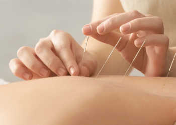 Akupunktur bei Rückenschmerzen © Africa Studio / shutterstock.com