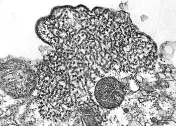 Nipah Virus © CDC / C. S. Goldsmith, P. E. Rollin / Wikimedia Commons