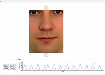 Gesichtsmuskulatur-Training mit der Biofeedbacklupe bei Gesichtslähmung, Fazialisparese. © UKE / Anke Schlüter