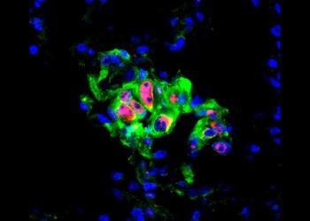 Lungenkrebs-Mikrometastase in der Maus: In den rot markierten Zellen ist der zentrale Stress-Schalter JNK aktiv. Krebszellen sind grün, Zellkerne blau gefärbt. © Tsunaki Hongu / DKFZ