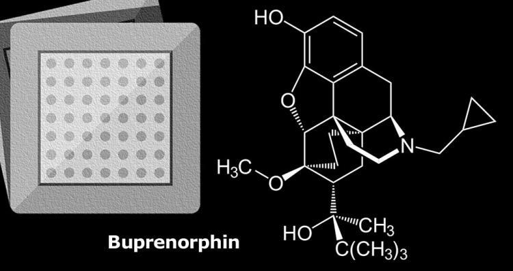 Buprenorphin: Opioid gegen chronische Schmerzen – sicher und effektiv