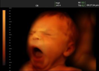 Babywatching Ultraschall © Valentina Razumova / shutterstock.com