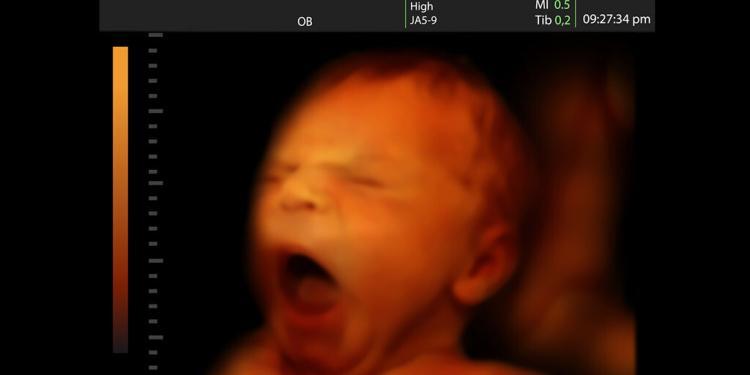 Babywatching Ultraschall © Valentina Razumova / shutterstock.com