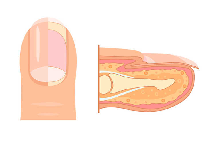 Der menschliche Nagel anatomisch betrachtet Aufbau und Funktion