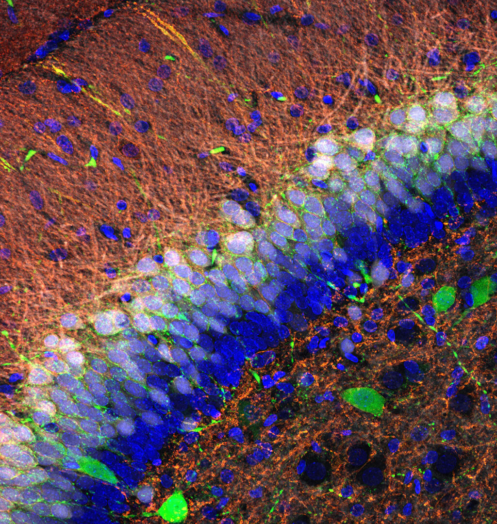 Körnerzellen (blau) verarbeiten und verschlüsseln Informationen und fügen sie zu einer Art Karte im Gyrus Dentatus zusammen. © Nature Communications