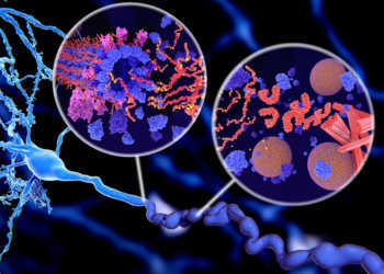Alzheimer-Krankheit: Pathologische Tau-Protein (rot-orange) Phosphorylierung (gelb) führt zu einer Zersetzung von Mikrotubuli und zur Aggregation von neurofibrillären Dreiecken (Orange) in einer Neuronaxon. © Juan Gaertner / shutterstock.com