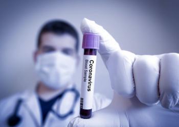Experten empfehlen, alle Patienten mit Grippe und schweren Erkältungen sofort auch auf SARS-CoV-2 und Covid-19 zu testen. © Sonis / shutterstock.com