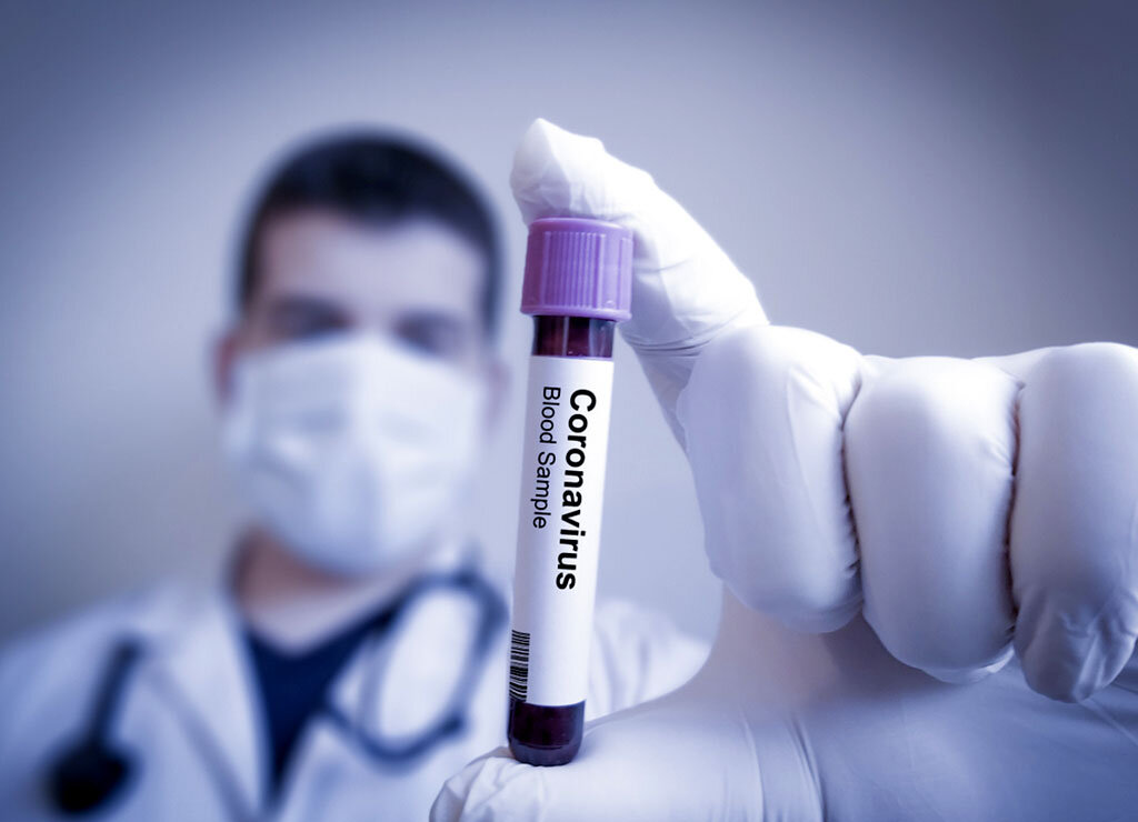 Experten empfehlen, alle Patienten mit Grippe und schweren Erkältungen sofort auch auf SARS-CoV-2 und Covid-19 zu testen. © Sonis / shutterstock.com