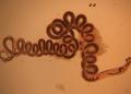 Der Parasiten-Larve Heligmosomoides polygyrus, gesehen in ein optisches Mikroskop, soll zukünftig eine wirksame Parasitentherapie gegen Allergien ermöglichen.(Entnommen aus dem Verdauungstrakt eines Nagetiers – Apodemus sylvaticus – Banyuls, Frankreich. © Naldo-Crocoduc / Creative Commons 3.0 / wikimedia