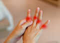 Steife Fingergelenke gehören zu jenen Symptomen, die Vorboten einer enzündlichen Rheuma-Erkrankung, Arthritis, sein können. © Blurry Me / shutterstock.com