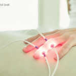 lasertherapie-arthrose-laserneedle